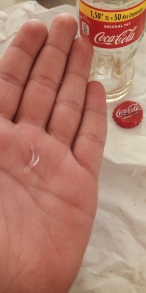 Coca Cola Kolanın İçinden Cam Çıktı